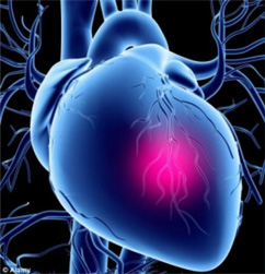 heart